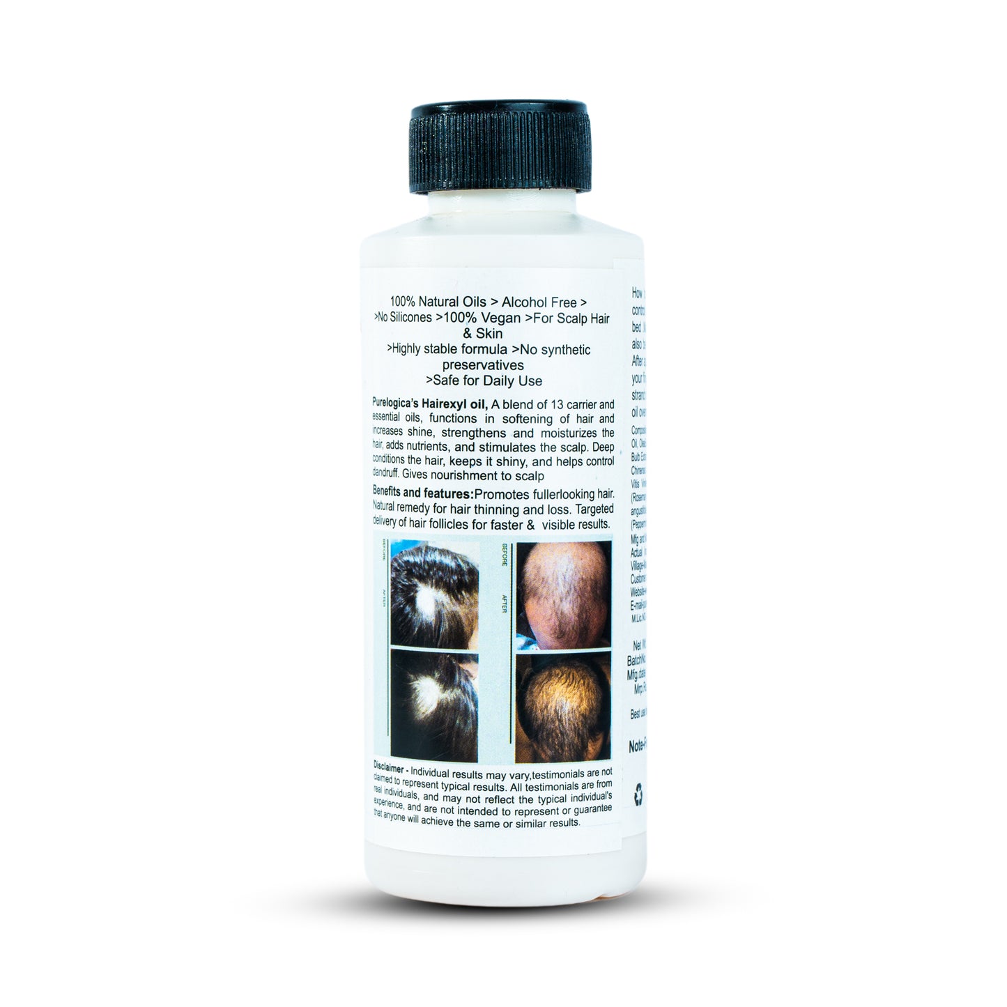 HairExyl Oil - Hair Growth Promoter Oil
